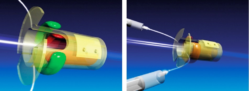 dispositivo inmovilizacion tubos administracion oxigeno pacientes anestesiados
