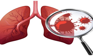 Siete países inician el ensayo de la primera vacuna contra el cáncer de pulmón