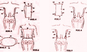 Dispositivo reductor de la carga sobre la columna vertebral