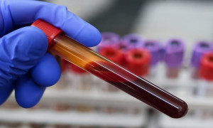 La sangre dorada el tesoro humano más raro y vital del planeta