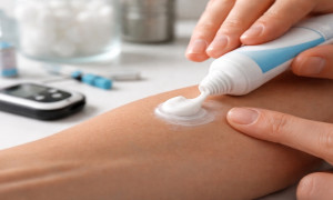 La insulina en crema que podría revolucionar el tratamiento de la diabetes y dejar atrás las agujas